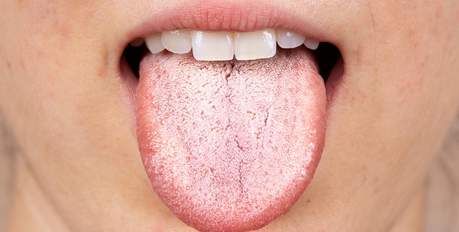 Welche Symptome treten bei einer Überwucherung mit Candida oder anderen Pilzen auf? Welche Symptome treten bei einer Überwucherung mit Candida oder anderen Pilzen auf?